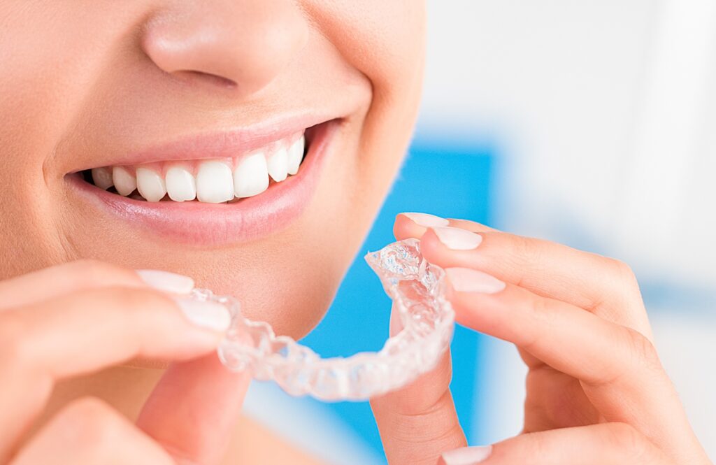 how invisalign works for straighter teeth 2